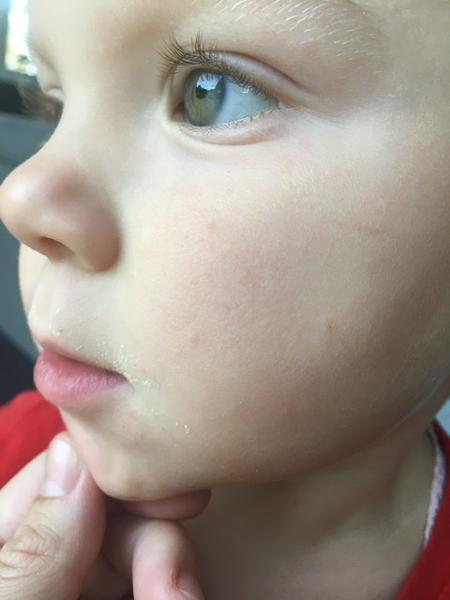 🙈 Jeden pupínkový. Poradíte?