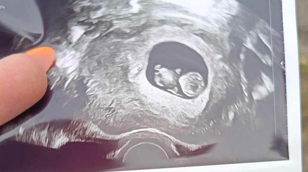 Jak odhadnout pohlaví dítěte před potvrzením lékařem?