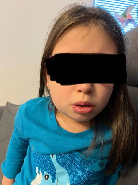 Rozpoznání zánětu slinné žlázy versus příušnice u dětí