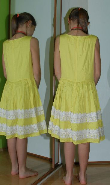 Bavlněné žluté letní šaty, 164