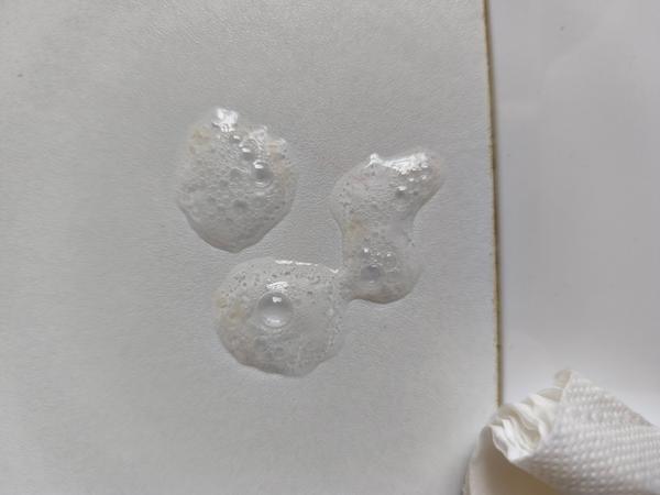 Je to krev ve slinách?