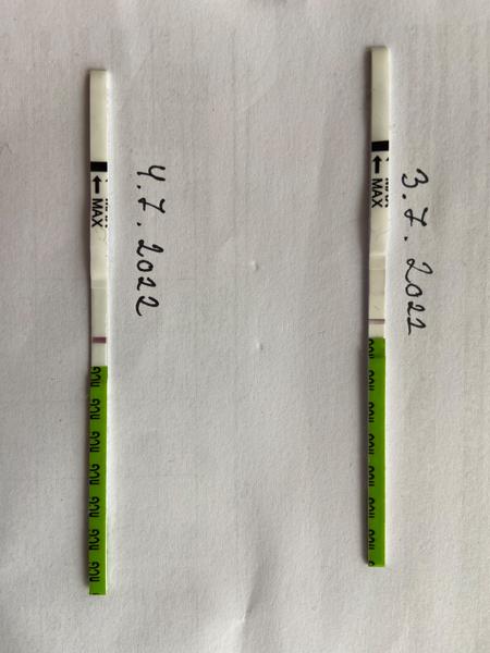 Zpoždění menstruace bez těhotenství. Co může být příčinou?