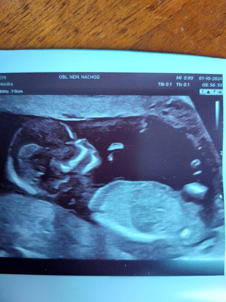 Lze z fotky určit pohlaví?