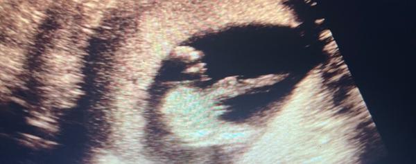 Holčička nebo chlapeček?