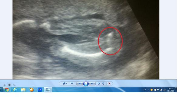 Holčička nebo chlapeček?