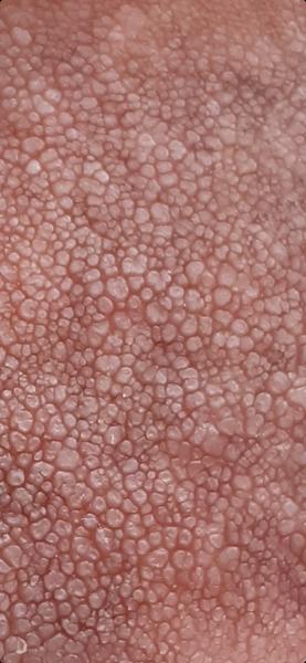 Nevíme, co to je. Poradíte, prosím?