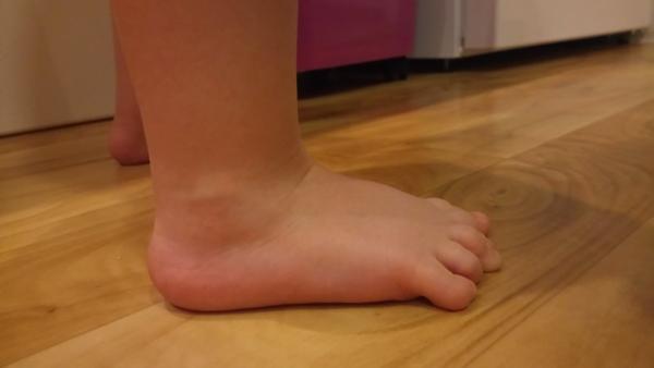 První boty pro deformované prsty. Jaké byste doporučila?