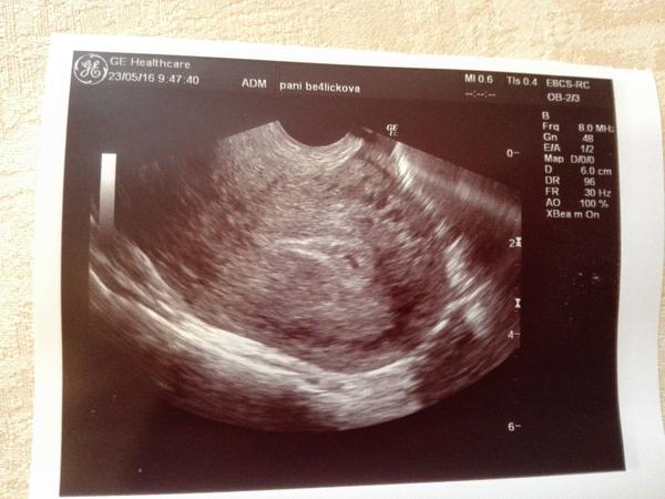 Dá se spočítat, v kolikátém jsem týdnu těhotenství?