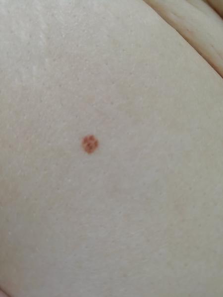 Podezřelé znaménko. Máte s takovým zkušenost?