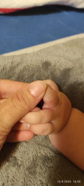 Jak pomoci miminku s vyrážkou a ekzémem?