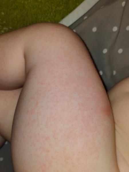 Pátá nemoc bez teploty u dítěte. Možné zkušenosti?