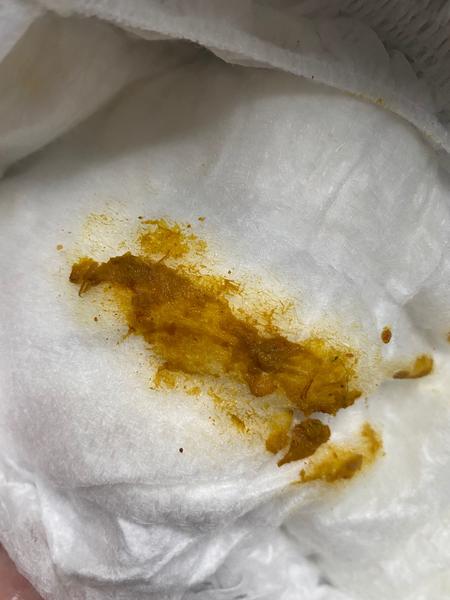 Nitky po banánu v plence. Je to možné?