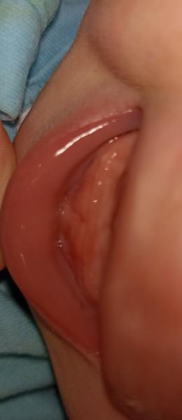 Jak poznat prořezávající se zuby u kojence?