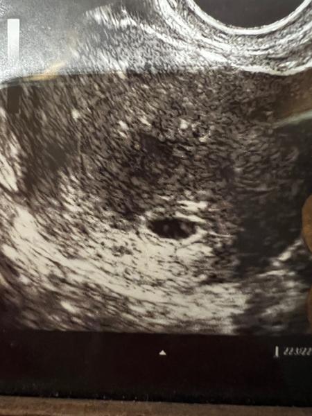 Mohl by být ultrazvuk ze začátku 6. tt?