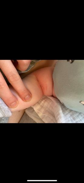 Je to kvasinka nebo něco jiného?