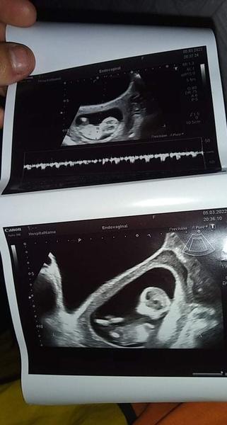 Kluk nebo holka? Jak poznat pohlaví miminka?