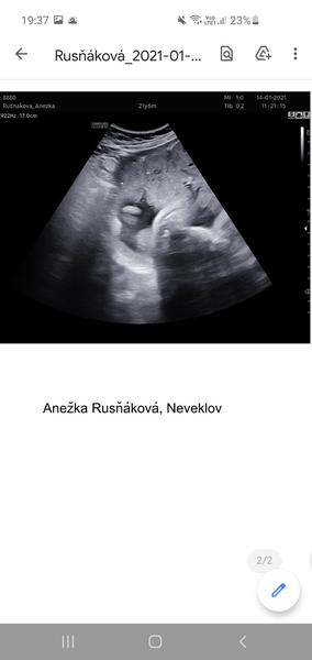 Vidíte tam pohlaví?