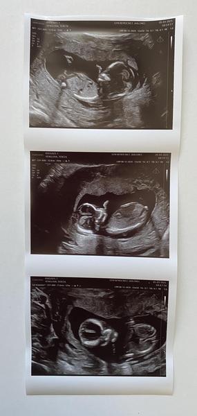 Bude to holka nebo kluk?