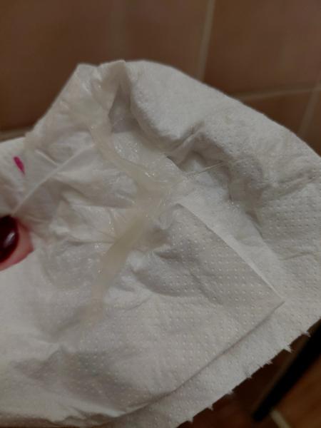 Je to hlenová zátka