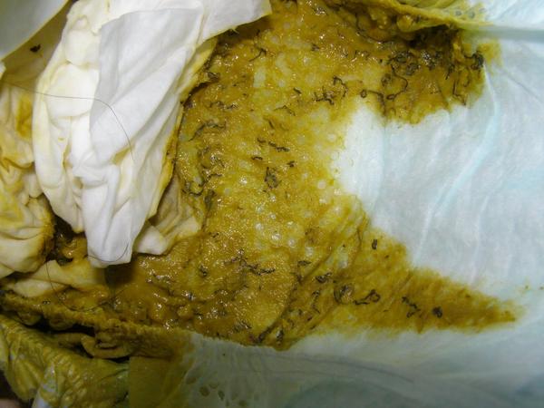 "Kopr" ve stoličce? Co to může být?