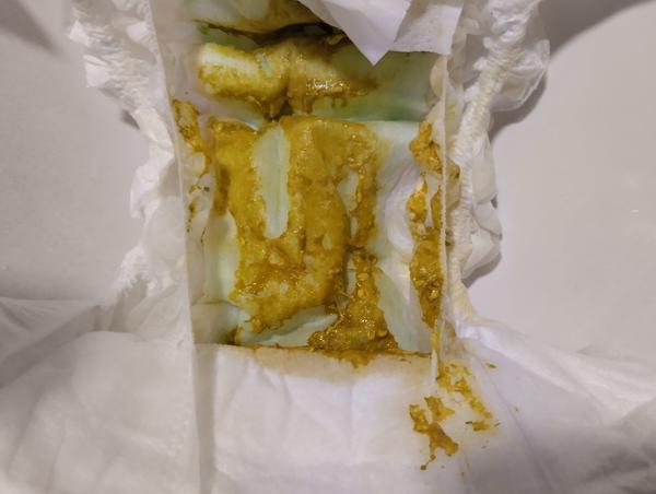 Kojené dítě. Má mít kyselou a hlenovitou stolici?