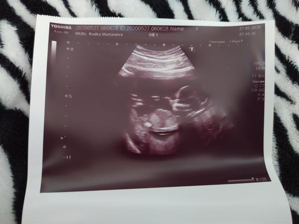 Pohlaví. Lze poznat?