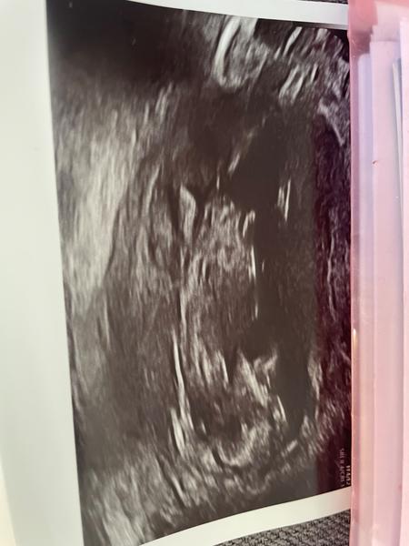 Jak tipnout pohlaví dítěte? Získejte názory ostatních uživatelů.