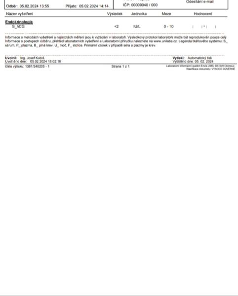 Příznaky těhotenství na úplném začátku: Může jít o těhotenství?