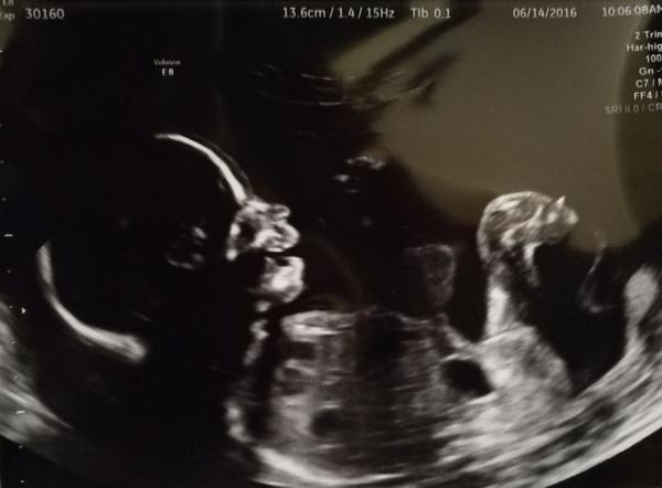 Prosím poraďte jména pro holčičku 