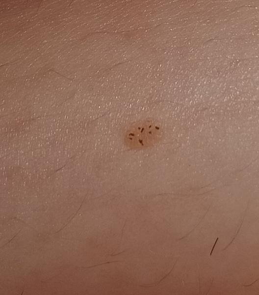 Skvrny v těhotenství. Co to může být?