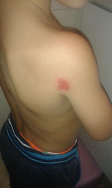 Slezl stroupek, červené místo se zvětšuje, mokvá