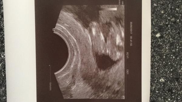 Bude to holka nebo kluk?