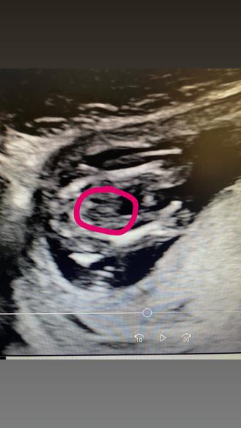 Fotka. Holka nebo kluk?