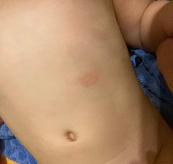 Podrážděná pokožka. Je možné, že podráždění trvá tak dlouho?