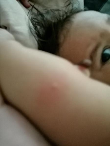 Pupínky. Co to může být?