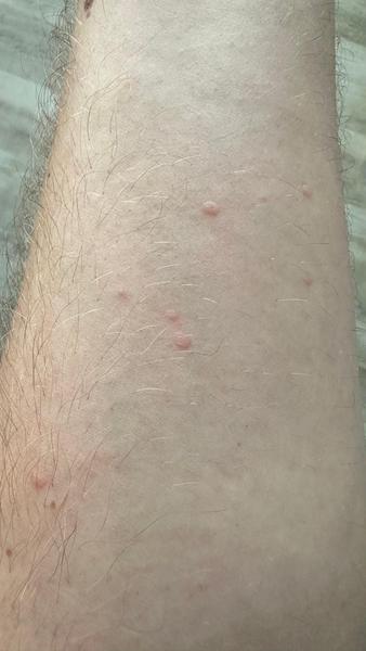 Možné příčiny pupínků po kontaktu se psem?