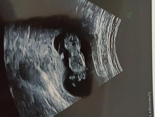 11+5 utz - je to holka. Mám s tím počítat?