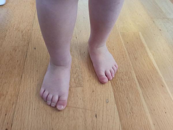 Tenisky na hubenou nožku - protetika Dony, Jonap Slim B7 nebo Ricosta. Je šance, že něco sedne?