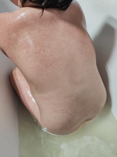 Může to být pátá nemoc?