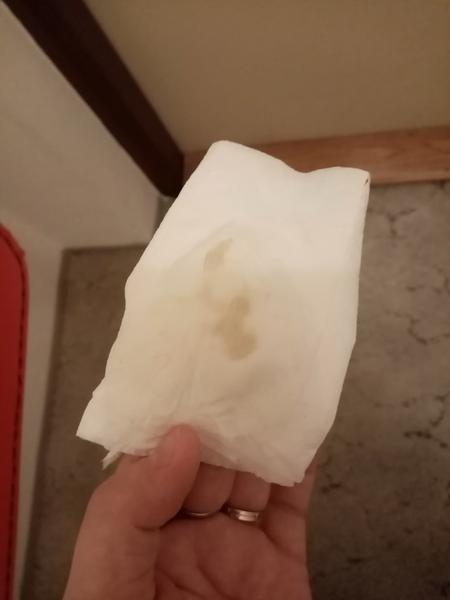 Je to hlenová zátka nebo jen výtok?