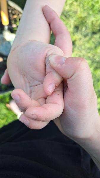 Možné příčiny svědivé vyrážky u dvouletého dítěte