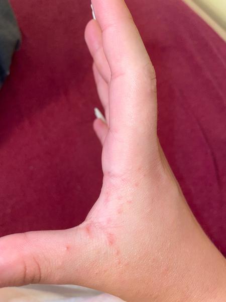 Pupínky. Co by to mohlo být?