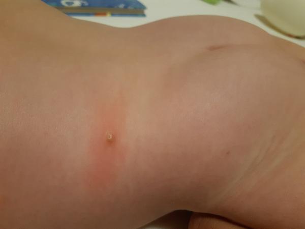 Skvrny. Co by to mohlo být?