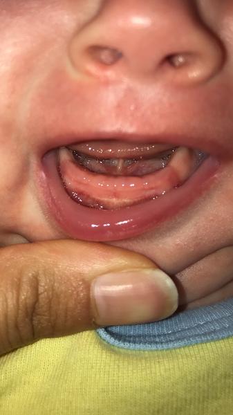 Mohou to být zoubky?