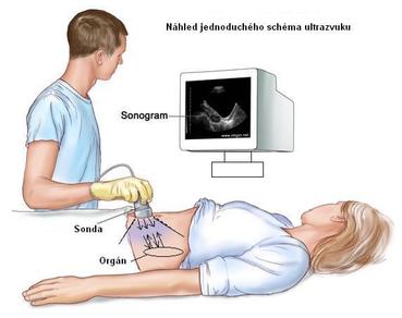 UTZ vyšetření lekářem