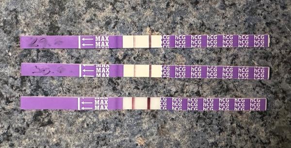 Je pobolívání podbřišku v raném těhotenství normální?