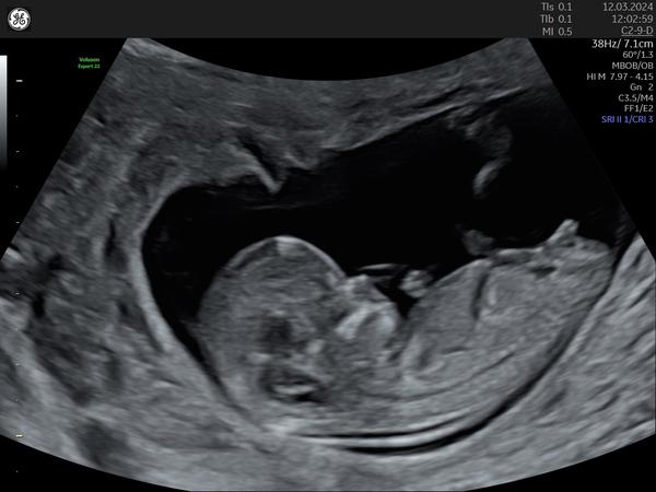 Určení pohlaví z fotky - 1. screening. Co myslíte?