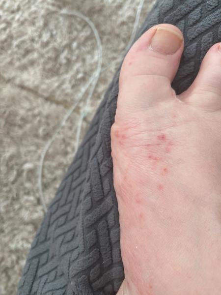 Vyrážka. Co by to mohlo být?