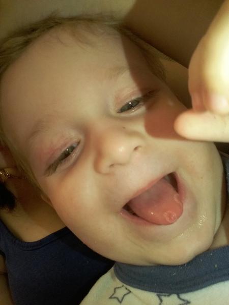 Bílé mapky (flíčky) na jazyku