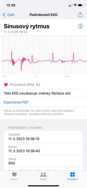 Chápete význam EKG záznamu se sestupným úsekem?